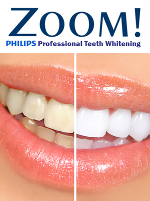 Zoom! Professional Teeth Whitening